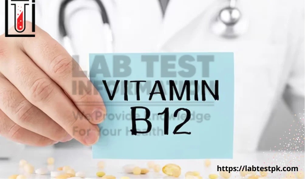 Vitamin B12 Test