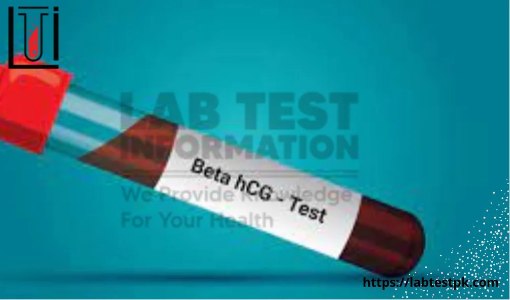 Beta HCG Blood Test, Procedure, Risk Lab Test Information