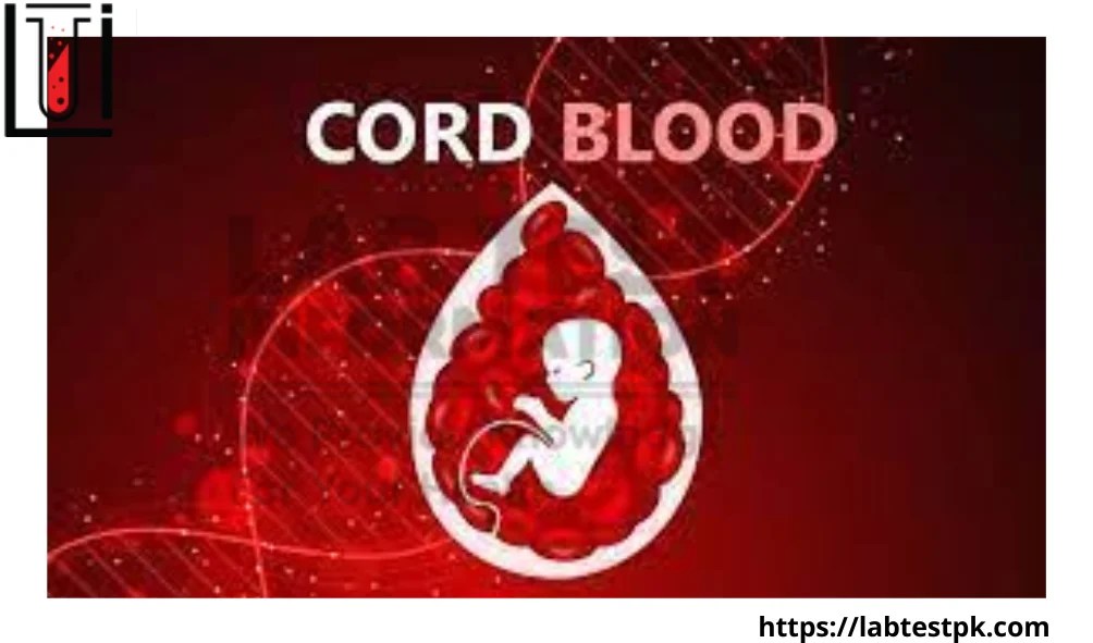Cord blood Stem Cells