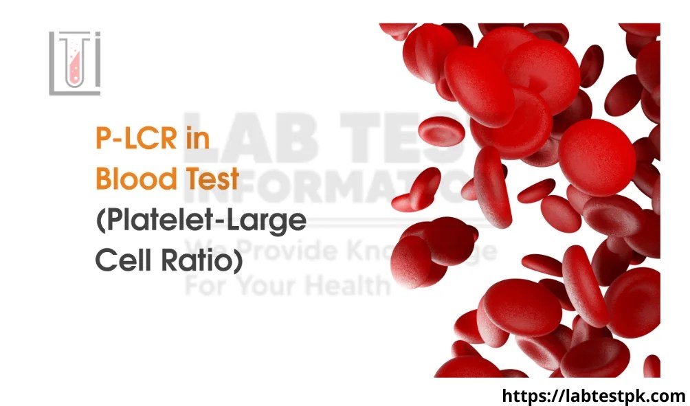 PLCR Blood Test Plateletlarge cell Lab Test Information