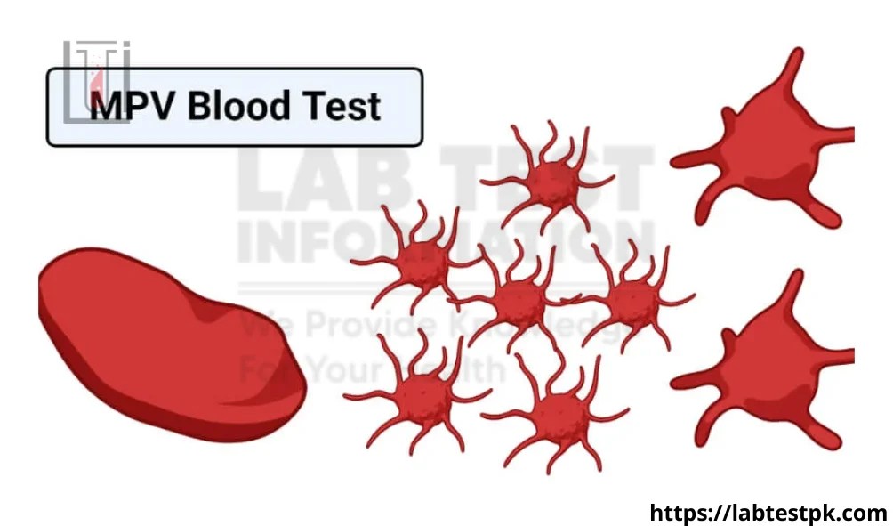 MPV (Mean Platelet Volume)