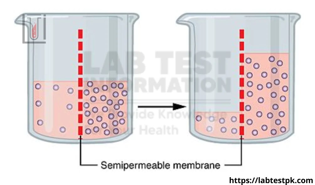 Osmolality Blood & Urine