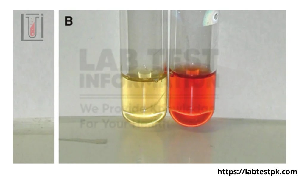 Urine Porphobilinogen, Random Urine Lab Test Information