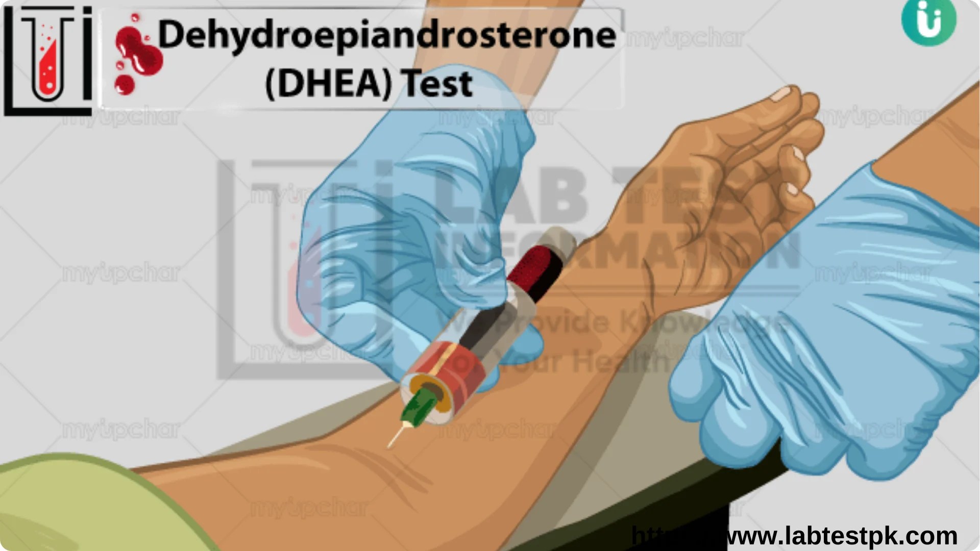 DHEA Sulfate Test
