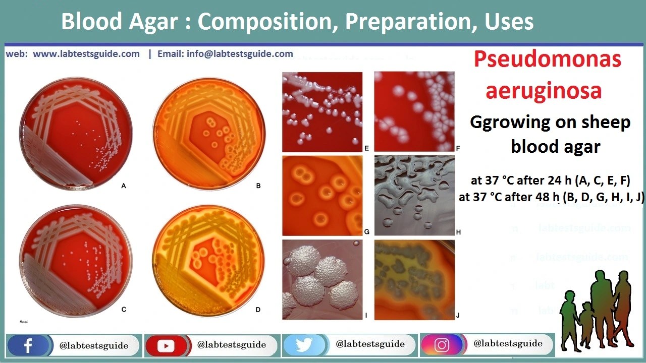 Blood Agar Ourpose, Composition, Results and more