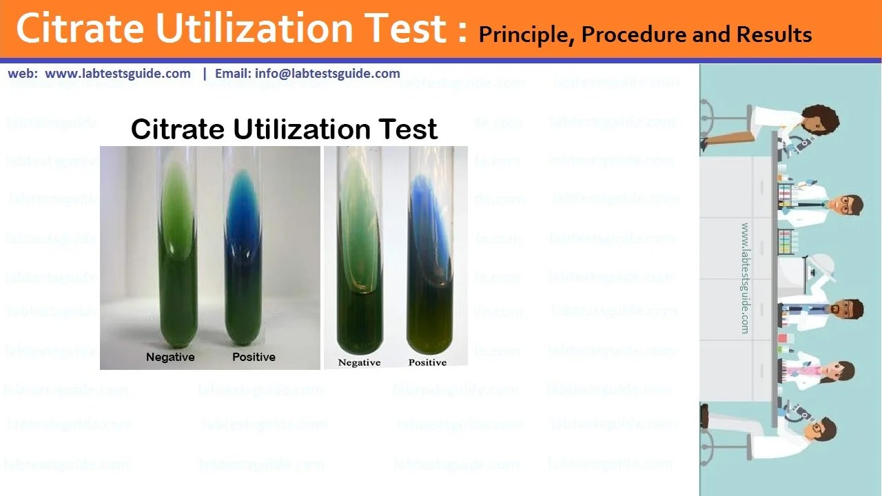 Citrate Utilization Test Lab Tests Guide