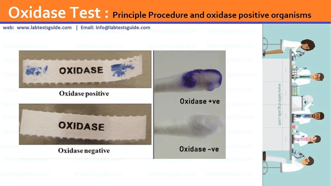 Oxidase Test Method Lab Tests Guide