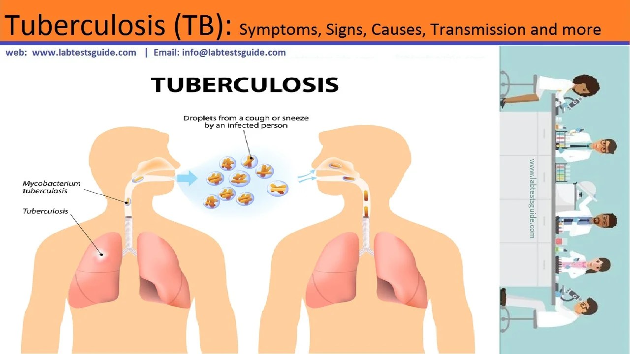 Tuberculosis (TB) Symptoms, Signs, Causes, Transmission and more Lab