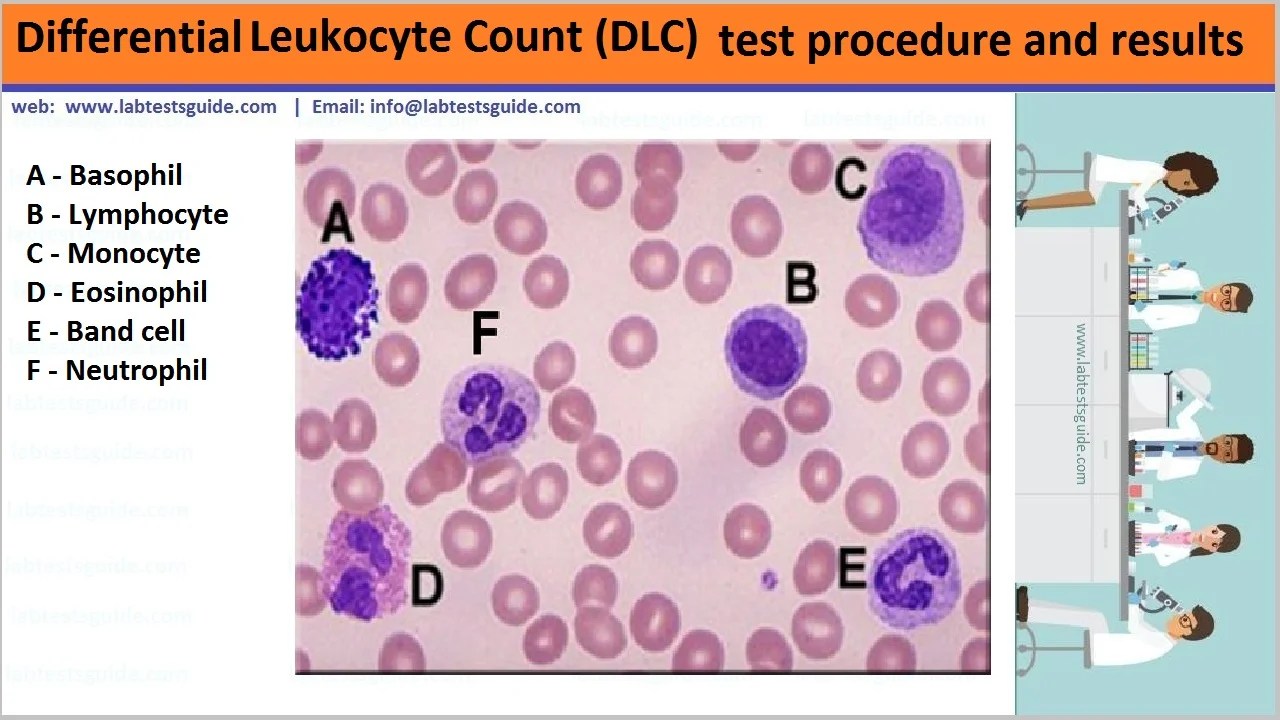 Differential Leukocyte Count (DLC) Test Procedure Lab Tests Guide