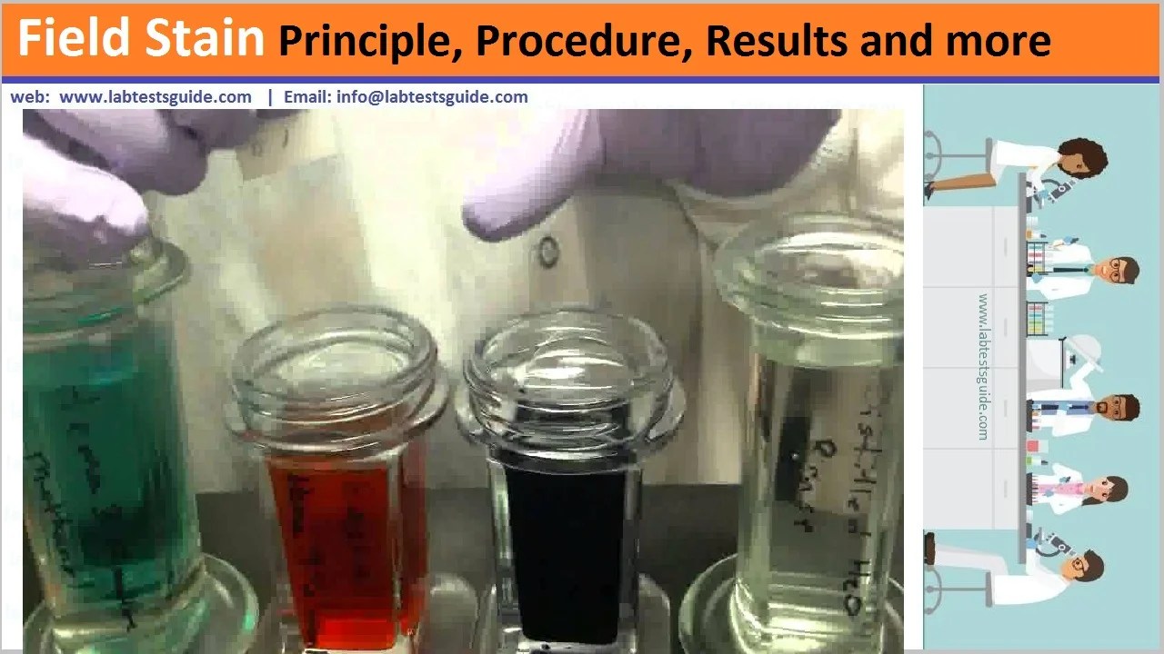 Field Stain Principle, Procedure, Results and more Lab Tests Guide