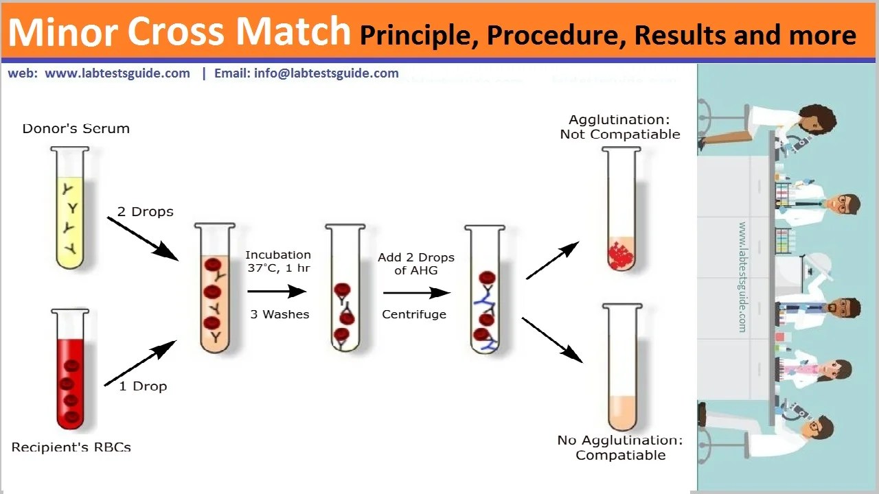 Minor Cross Match Procedure, Principle, Results and more Lab Tests Guide