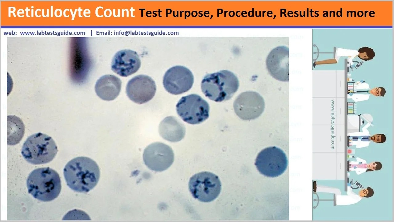 Reticulocyte Count Lab Tests Guide