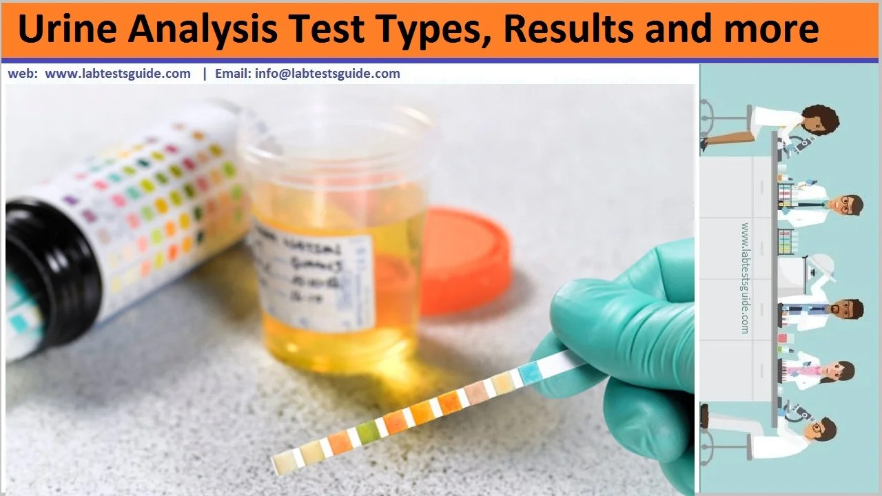 Urinalysis Urine Test, Types, Results and more Lab Tests Guide