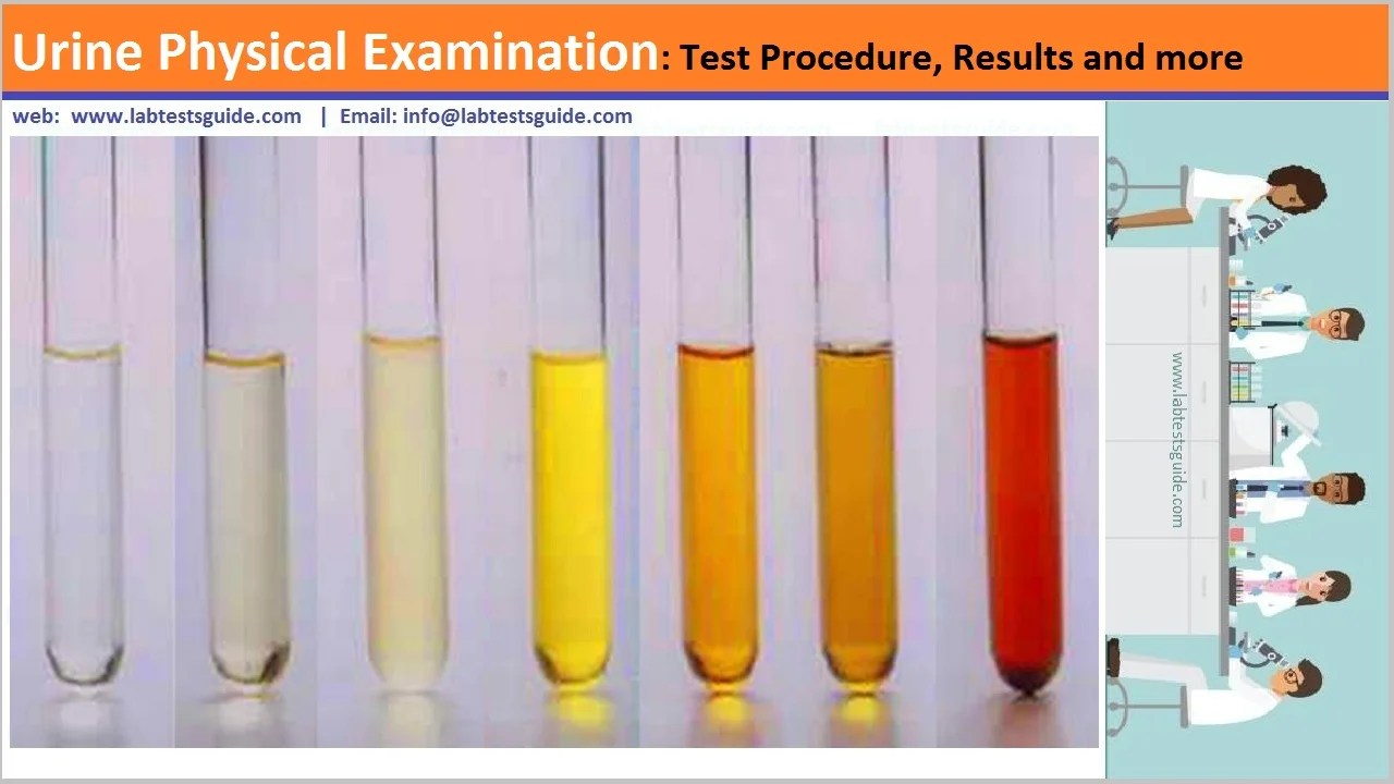 Urine Physical properties Purpose, Results an more Lab Tests Guide
