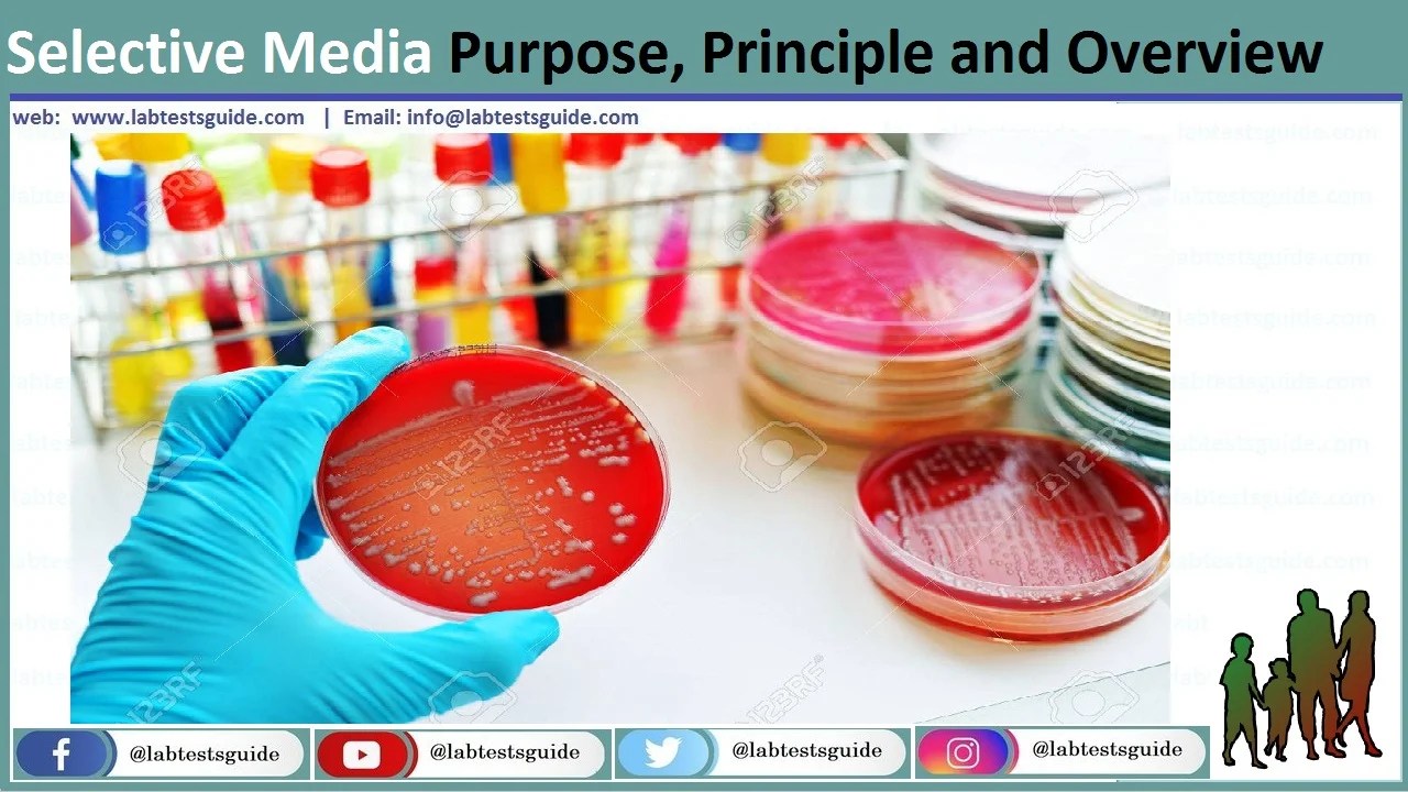 Selective Culture Media Purpose, Princople and overview Lab Tests Guide