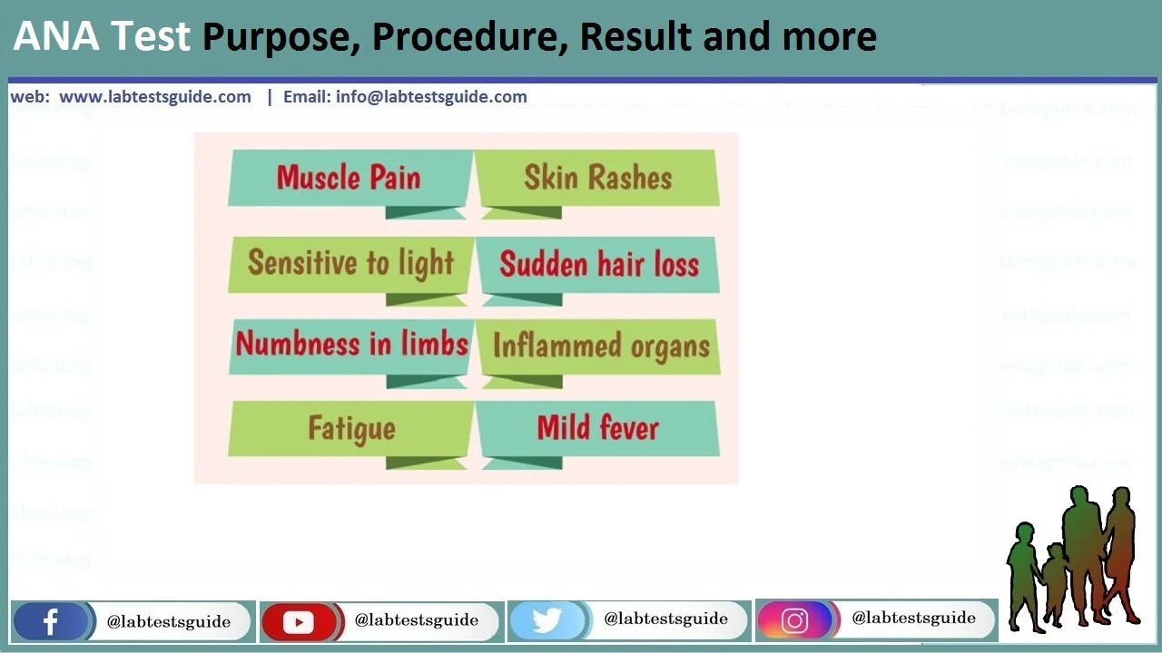 ANA Test Procedure, Results, Principle and more Lab Tests Guide