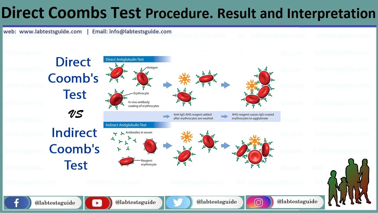 Direct Coombs Test Procedure. Result and Interpretation Lab Tests Guide