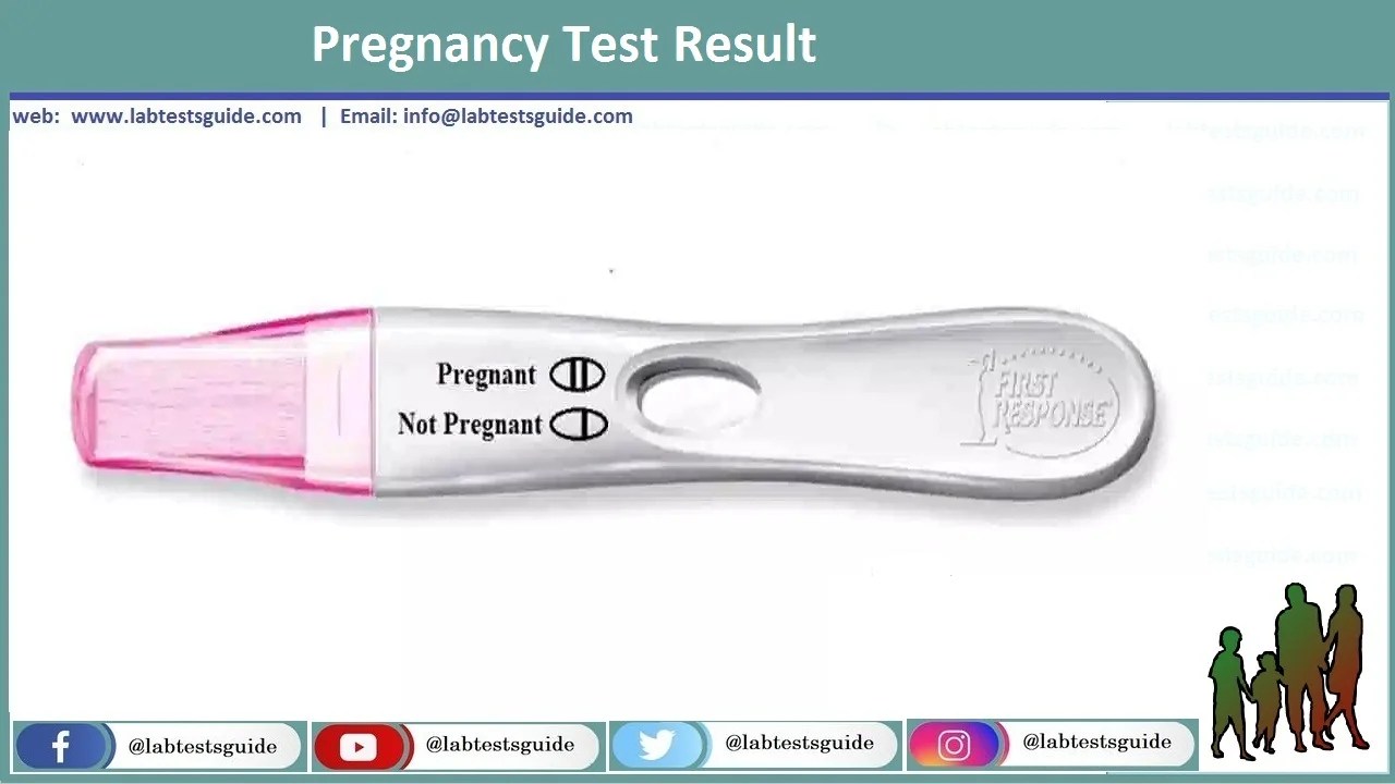 Pregnancy Test Principle, Procedure, Result and more Lab Tests Guide