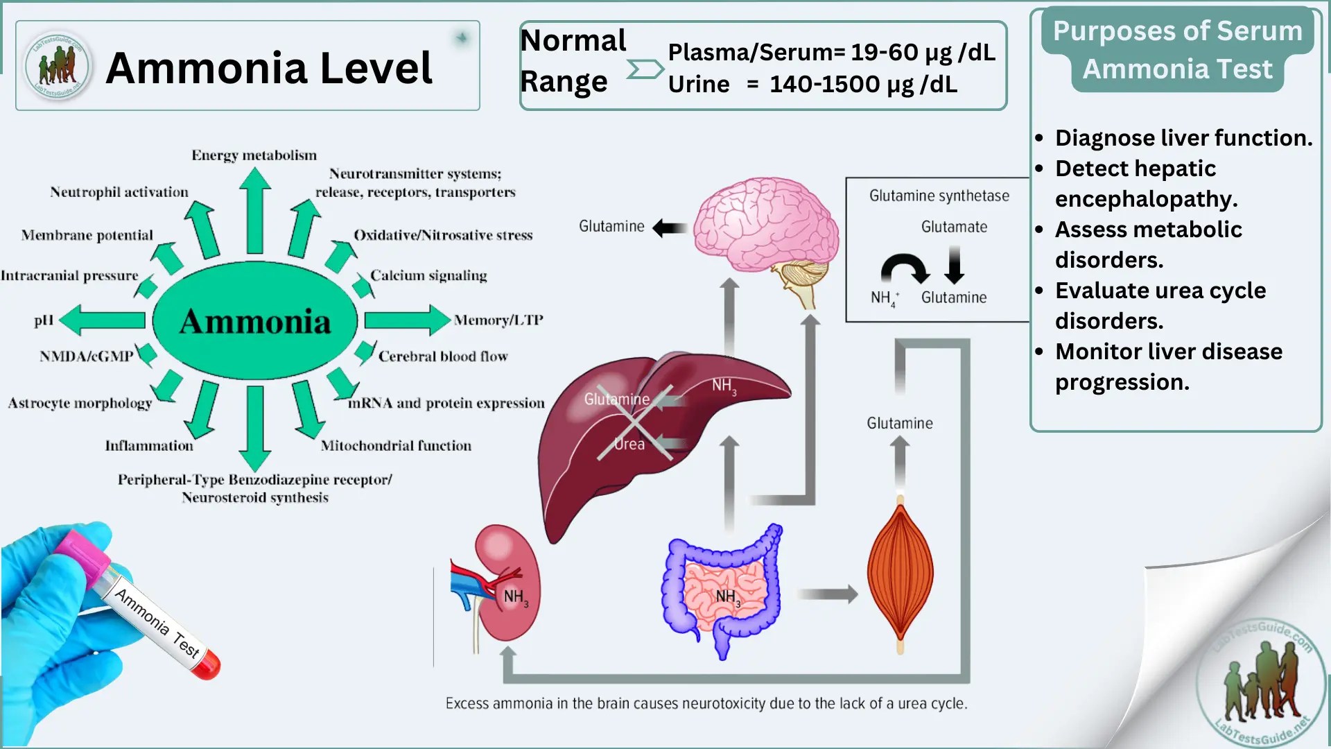 Serum Ammonia Test Purpose, Procdure, Result and more Lab Tests Guide