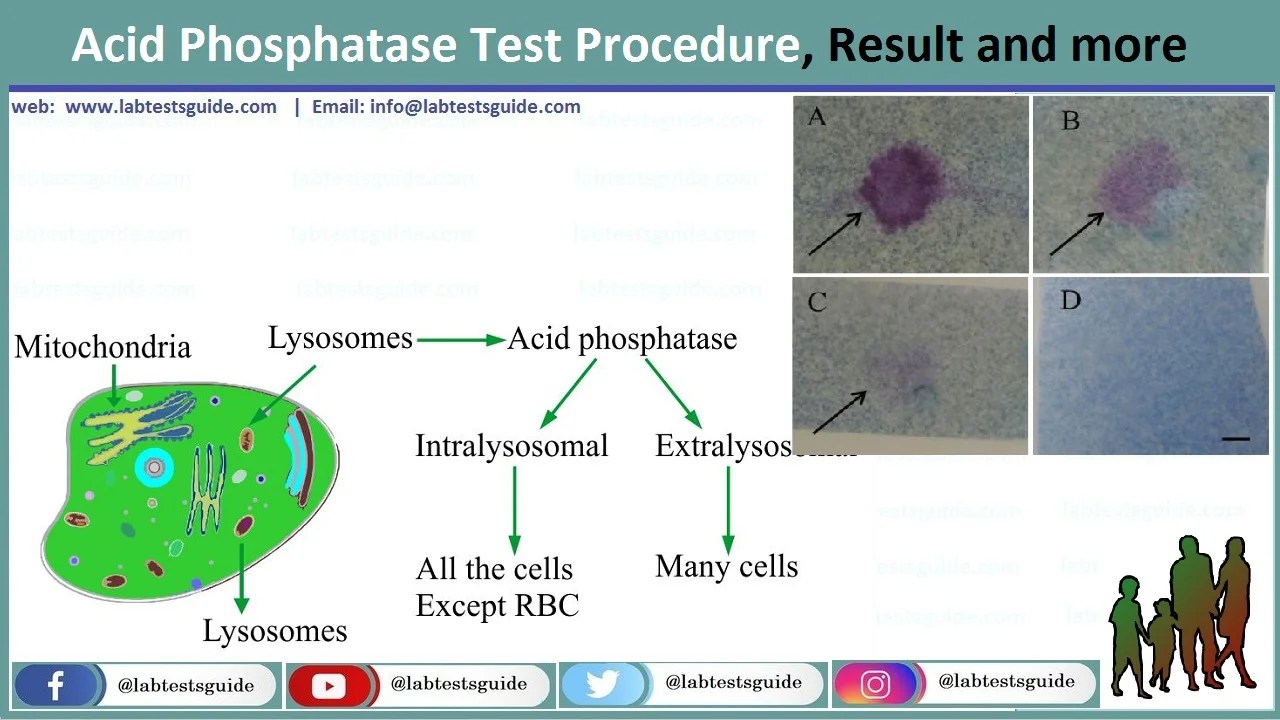 Acid Phosphatase Test Procedure, Result And More Lab Tests Guide