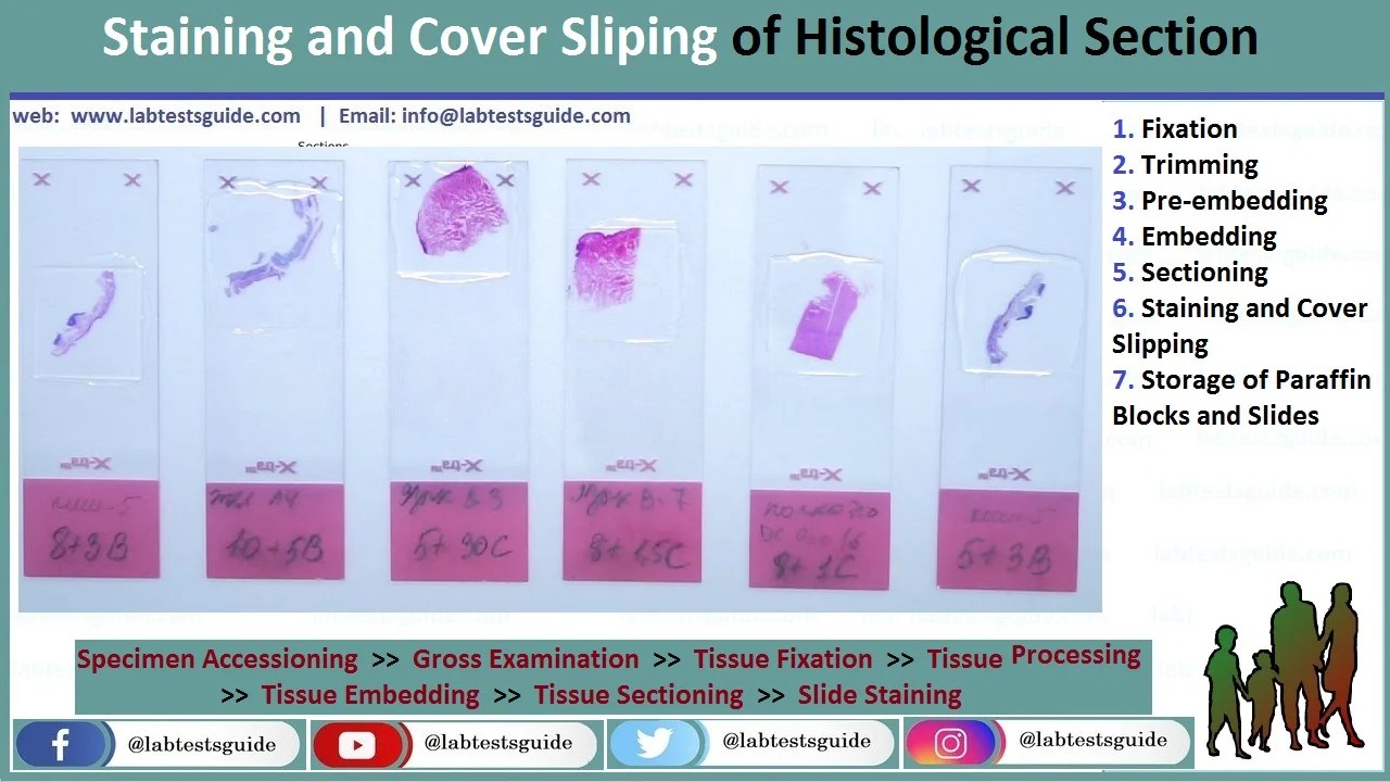 Staining and Cover Slipping Lab Tests Guide