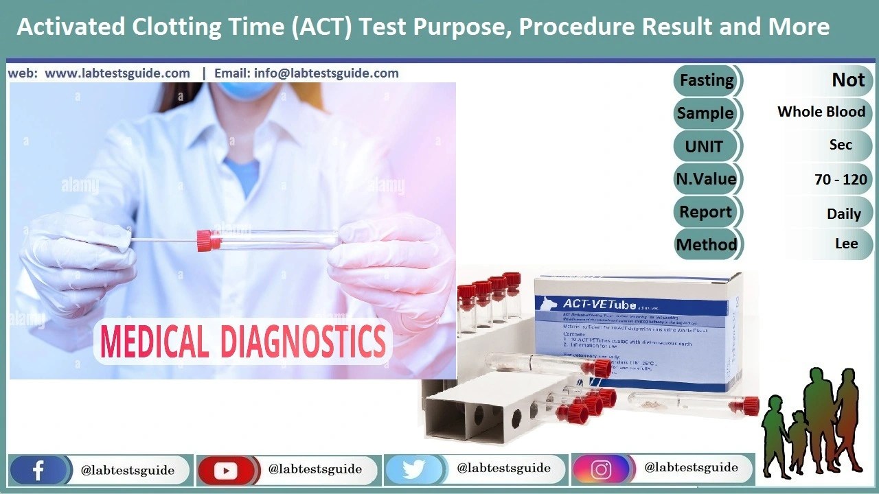 Activated Clotting Time Test Purpose, Procedure, Result and more