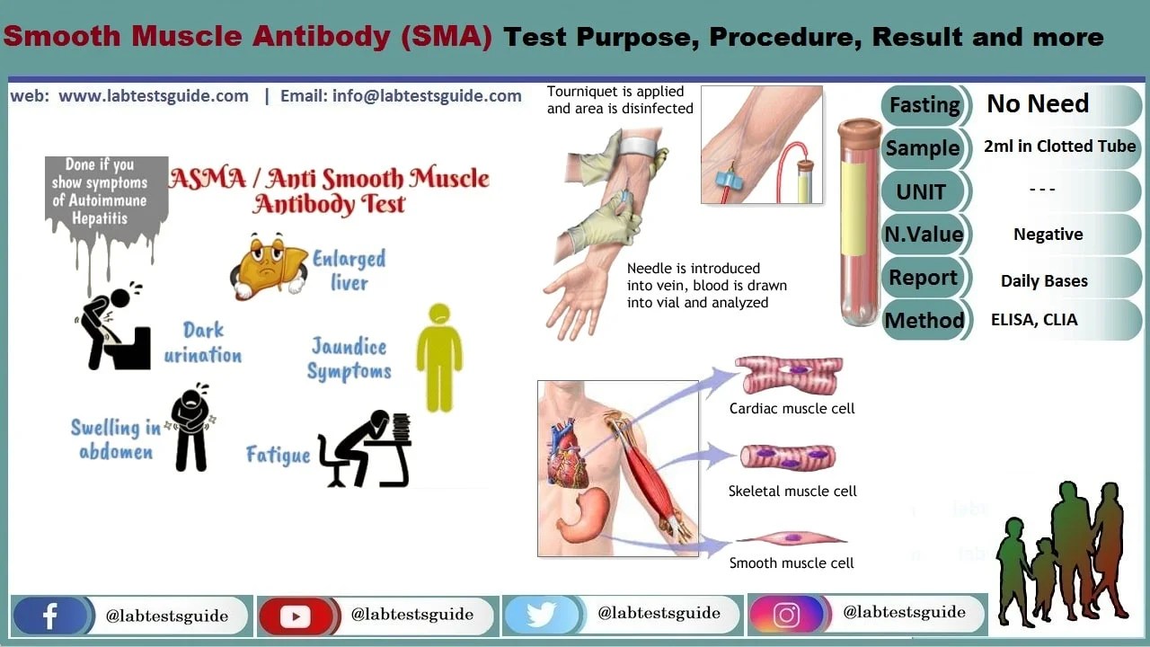Smooth Muscle Antibody Titers Test Purpose, Procedure, Result And More