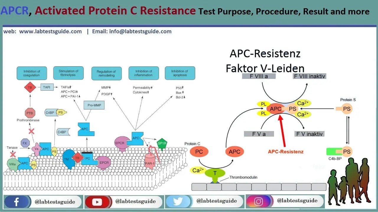 APC Resistance Symptoms, Diagnosis, and Treatment | Lab Tests Guide