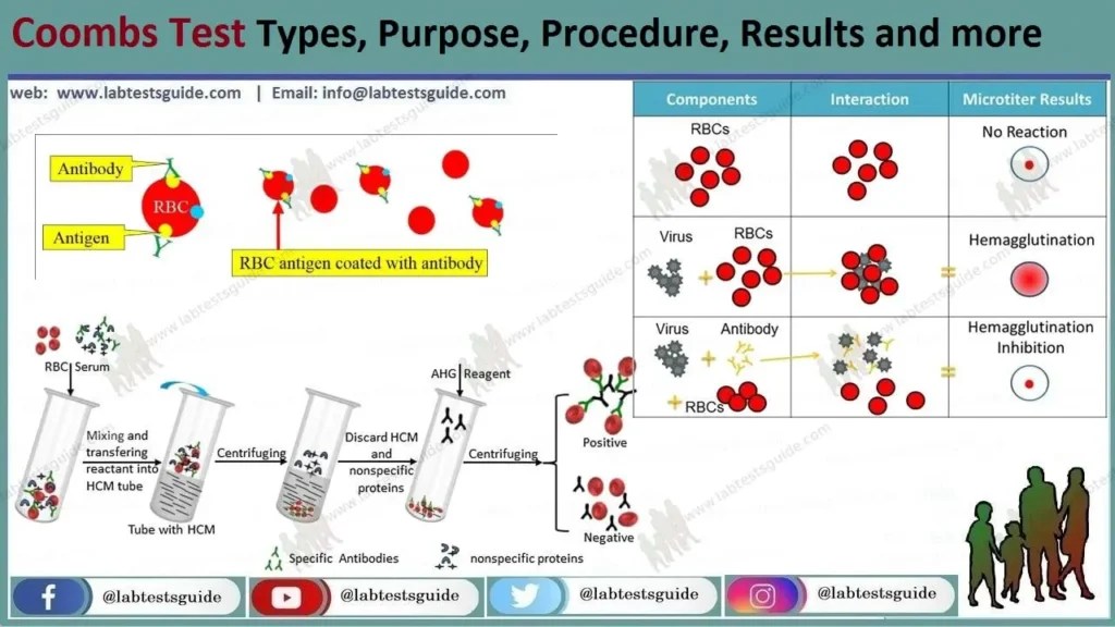 Anti Human Globulin Test, Explained A Crucial Immunohematology Procedure