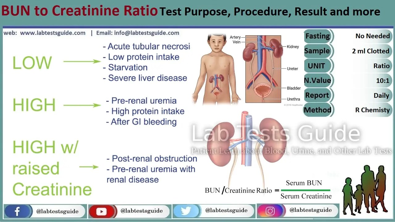 BUN Creatinine Ratio Lab Tests Guide