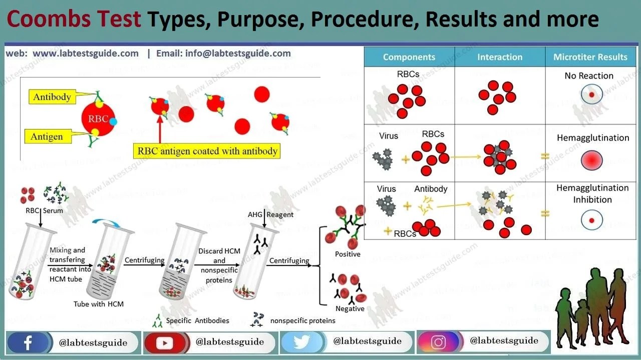 Indirect Coombs Test Purpose, Procedure, Results And More LTG