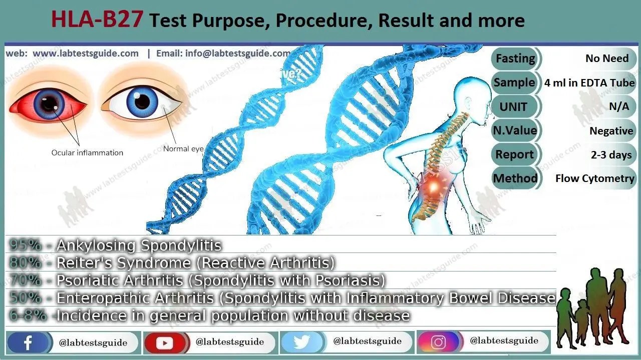 HLAB27 Test Purpose, Procedure, Result and more Descubra a emoção das