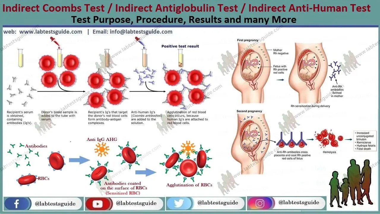 Indirect Antihuman Globulin Test Lab Tests Guide