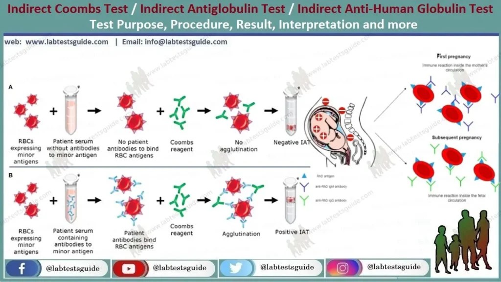 Indirect Coombs Test Procedure A StepbyStep Guide