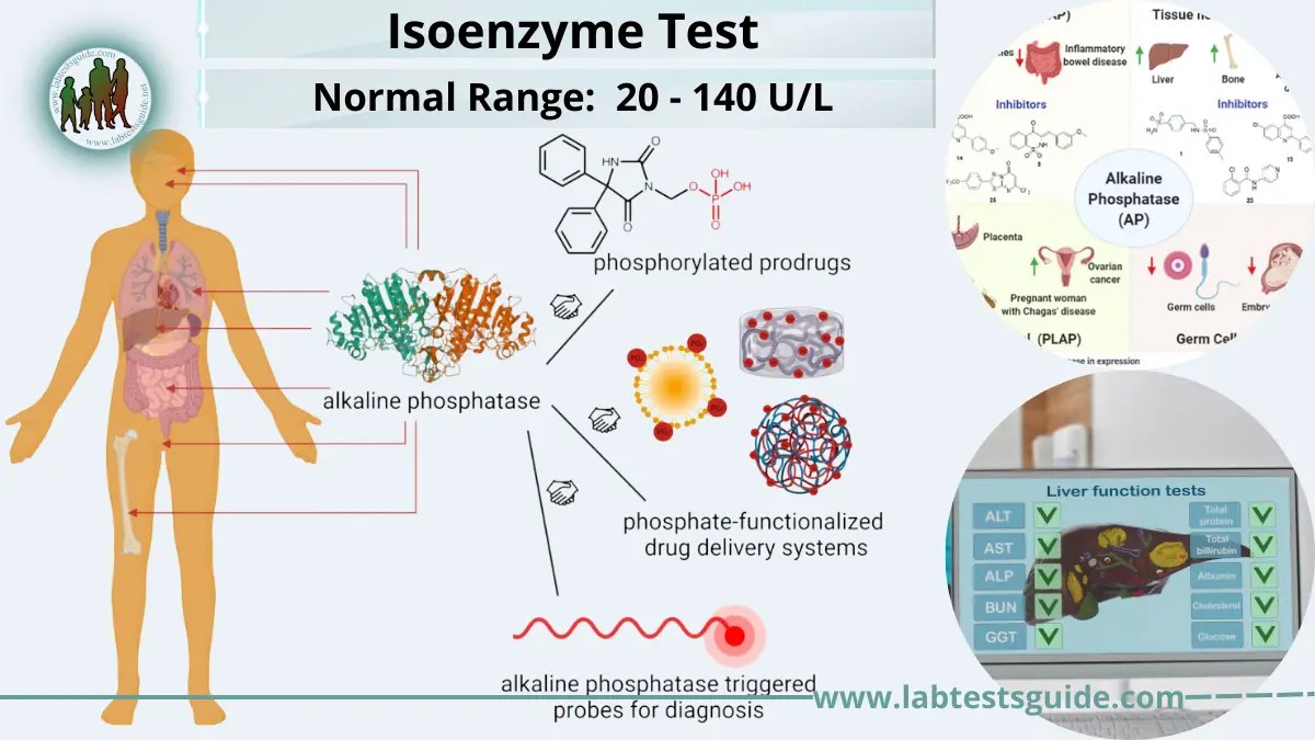 Isoenzyme Test Test Purpose, Procedure, Results Interpretation and more