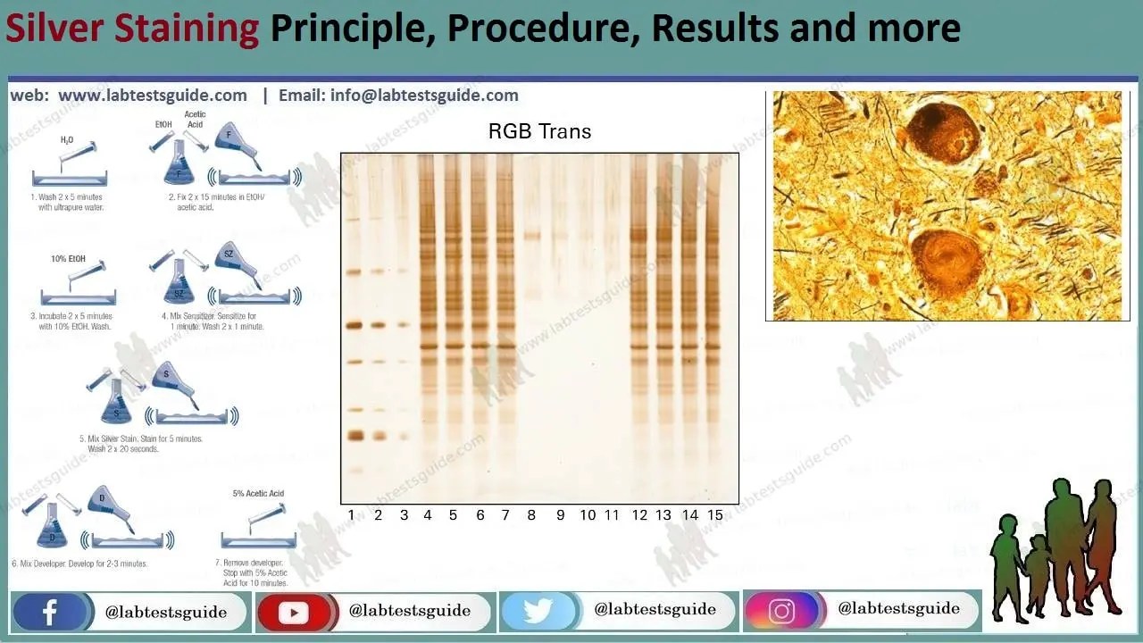 Silver Stain Technique Applications and Benefits in Histology and