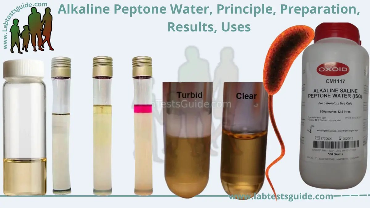Alkaline Peptone Water Uses, Preparation, and Benefits Complete Guide