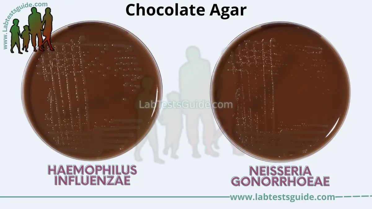 Chocolate Agar Composition, Preparation, and Uses Lab Tests Guide