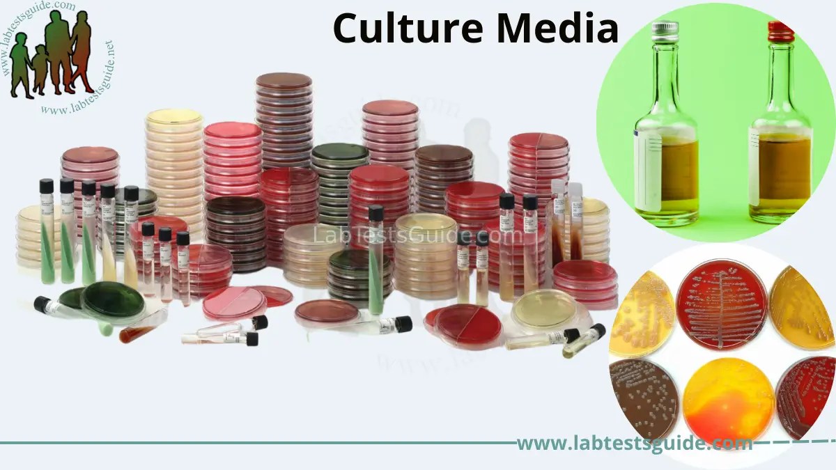 Culture Media Types, Preparation, and Uses A Comprehensive Guide