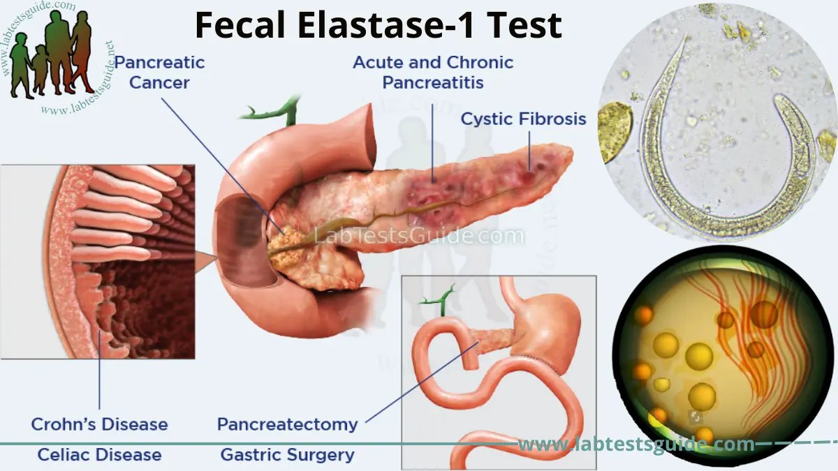 Fecal Elastase1 Test Purpose, Procedure, and Results Everything You