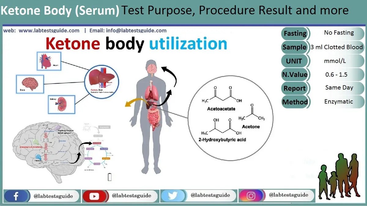 Ketone Bodies Definition, Testing, and Significance FAQs and Resources