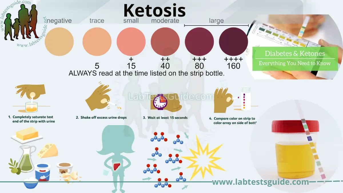 ketosis Definition, Causes, Symptoms, Diagnosis, and Treatment