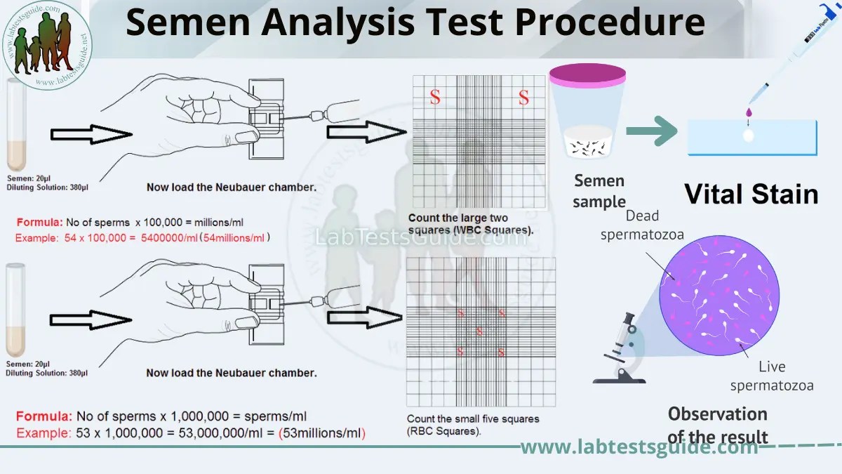 Semen Analysis Test