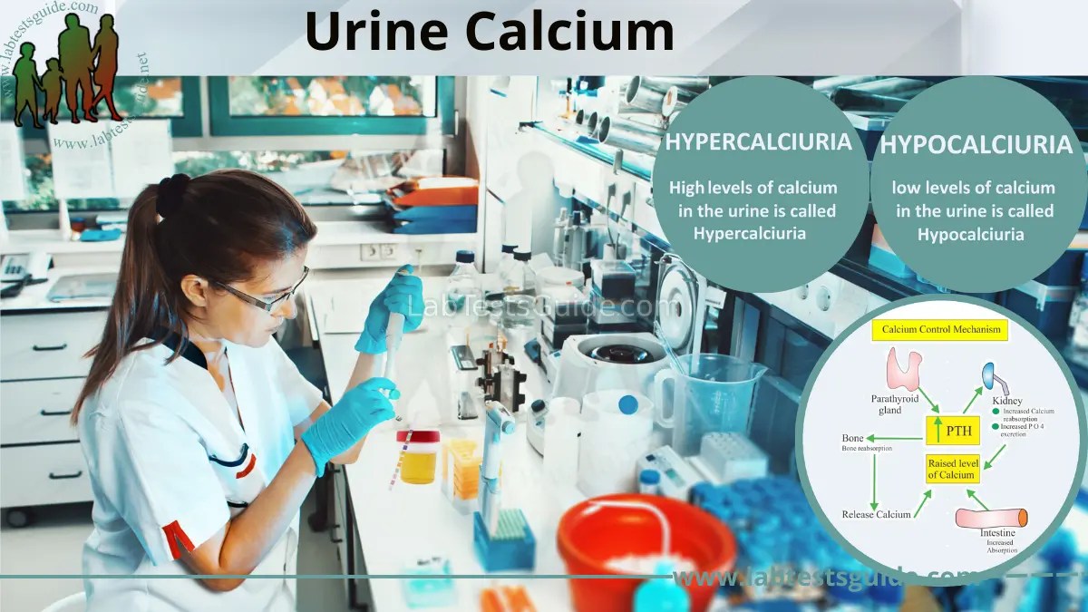 Urine Calcium Importance, Causes of Abnormal Levels, and Testing Procedure