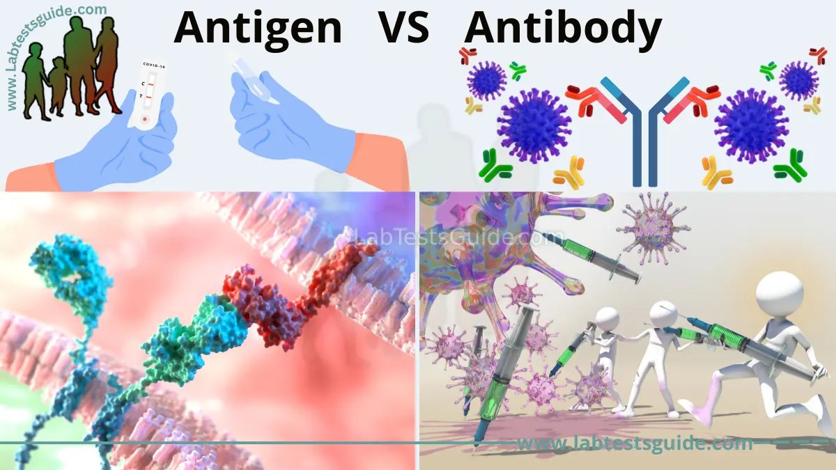 Difference Between Antigen and Antibody Lab Tests Guide
