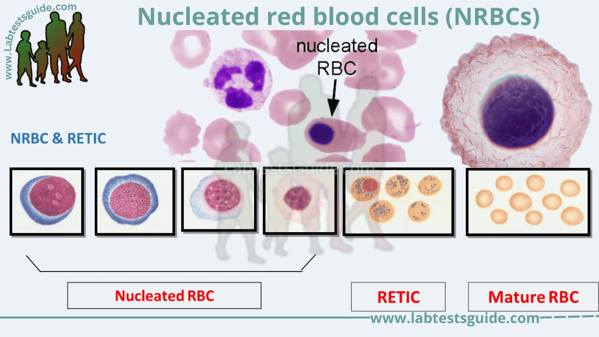 Nucleated Red Blood Cells Vs Lymphocyte