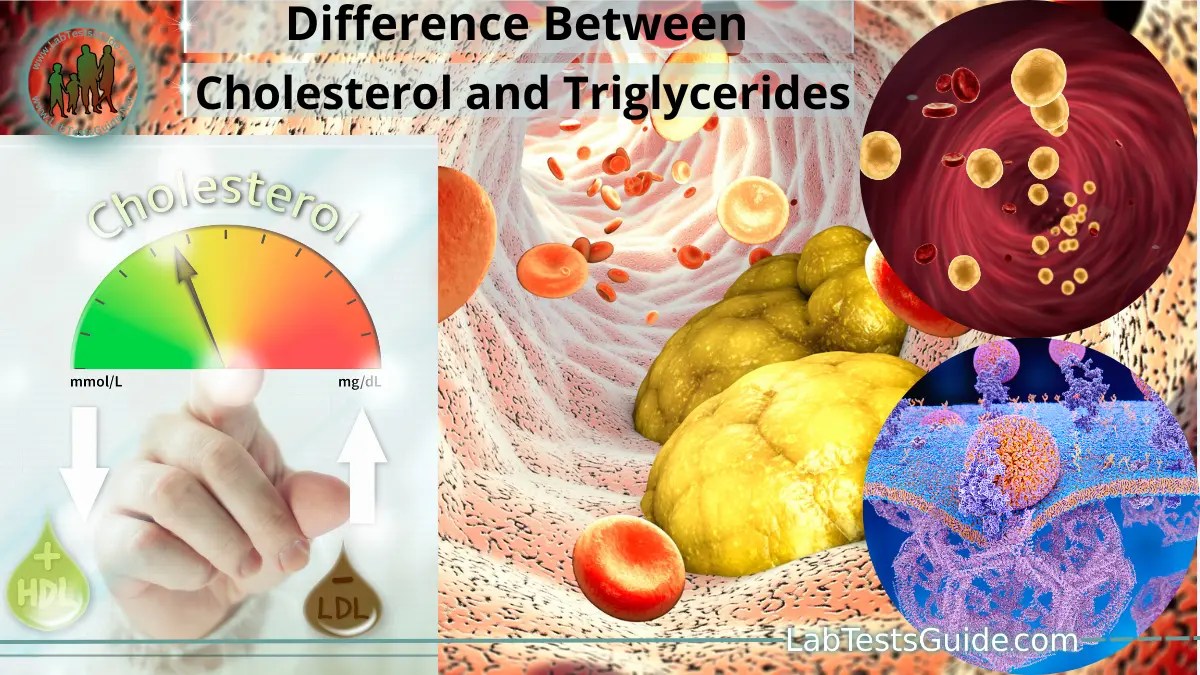 Differences Between Cholesterol and Triglycerides Lab Tests Guide