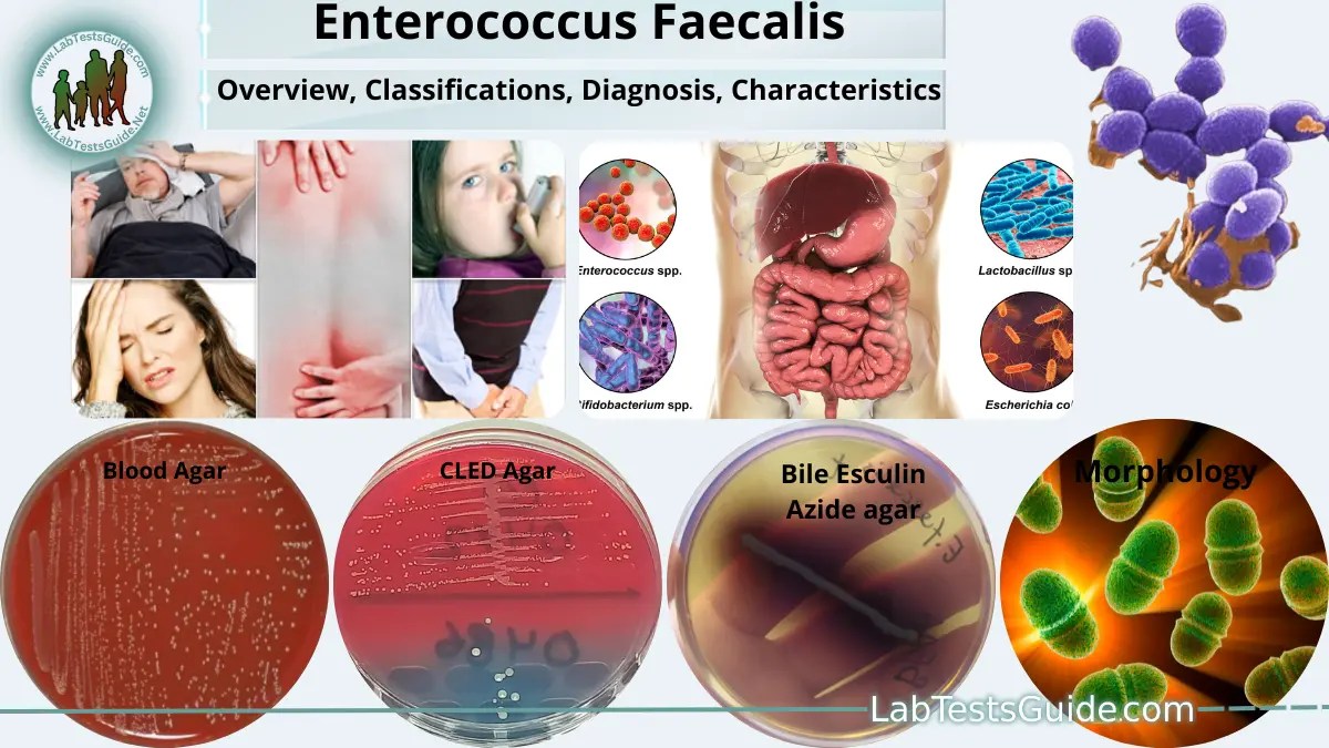 Enterococcus faecalis Overview, Symptoms, Diagnosis, Treatment and more