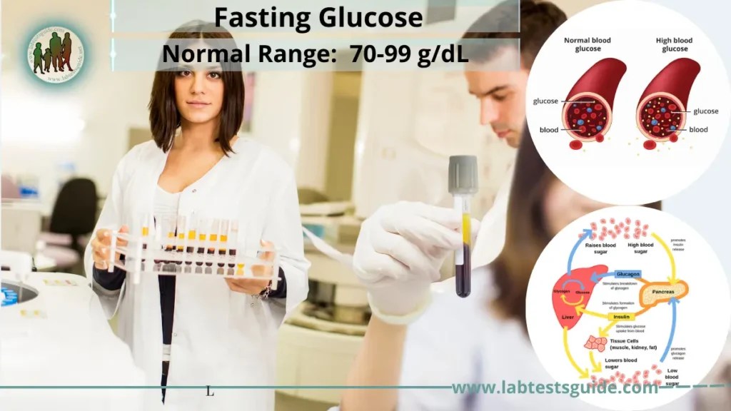 Fasting Glucose Test Lab Tests Guide