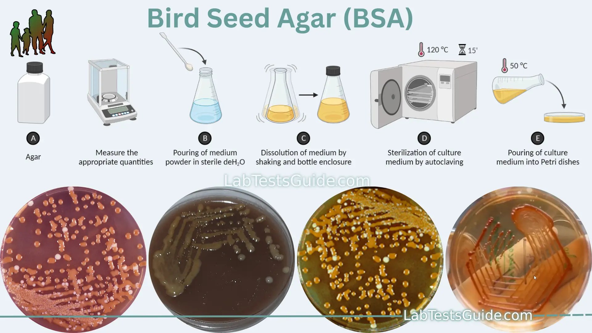 Bird Seed Agar (BSA) Purpose, Principles, Composition, Procedure, Result Interpretation etc